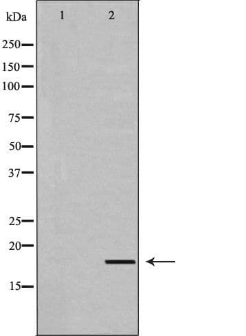 Polyclonal Rabbit anti-Human FAT10 / UBD Antibody (IHC, IF, WB)