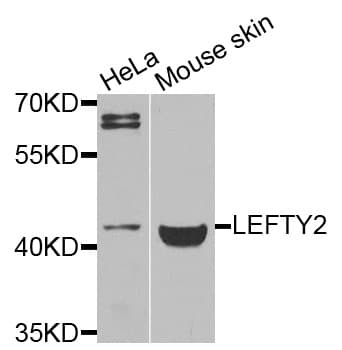 Polyclonal Rabbit anti-Human TGFB4 / LEFTY2 Antibody (WB)