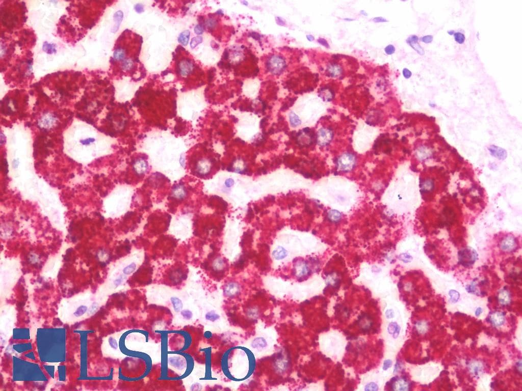 IHC-plus™ Polyclonal Rabbit anti-Human HMGCS2 / HMG-CoA Synthase 2 Antibody (aa478-508, IHC, WB)