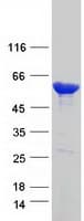 Human Carboxylesterase 1 / CES1 Protein (Recombinant Myc-DDK (Flag))