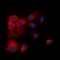 Polyclonal Rabbit anti-Human BCL2L2 / Bcl-w Antibody (C-Terminus, IHC, IF, WB)