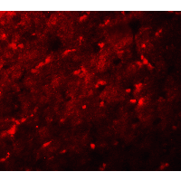 IHC-plus™ XBP1 Antibody
