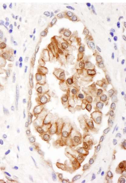 ABCB9 Antibody (aa475-525)