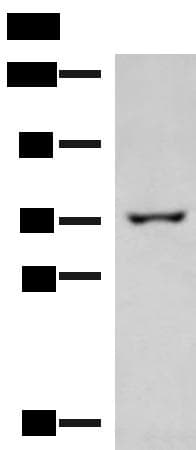 GLS / Glutaminase Antibody