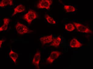 Polyclonal Rabbit anti-Human OR3A2+3 Antibody (IF, WB)