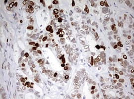 TOP2A / Topoisomerase II Alpha Antibody (aa1100-1531, clone OTI2A9)