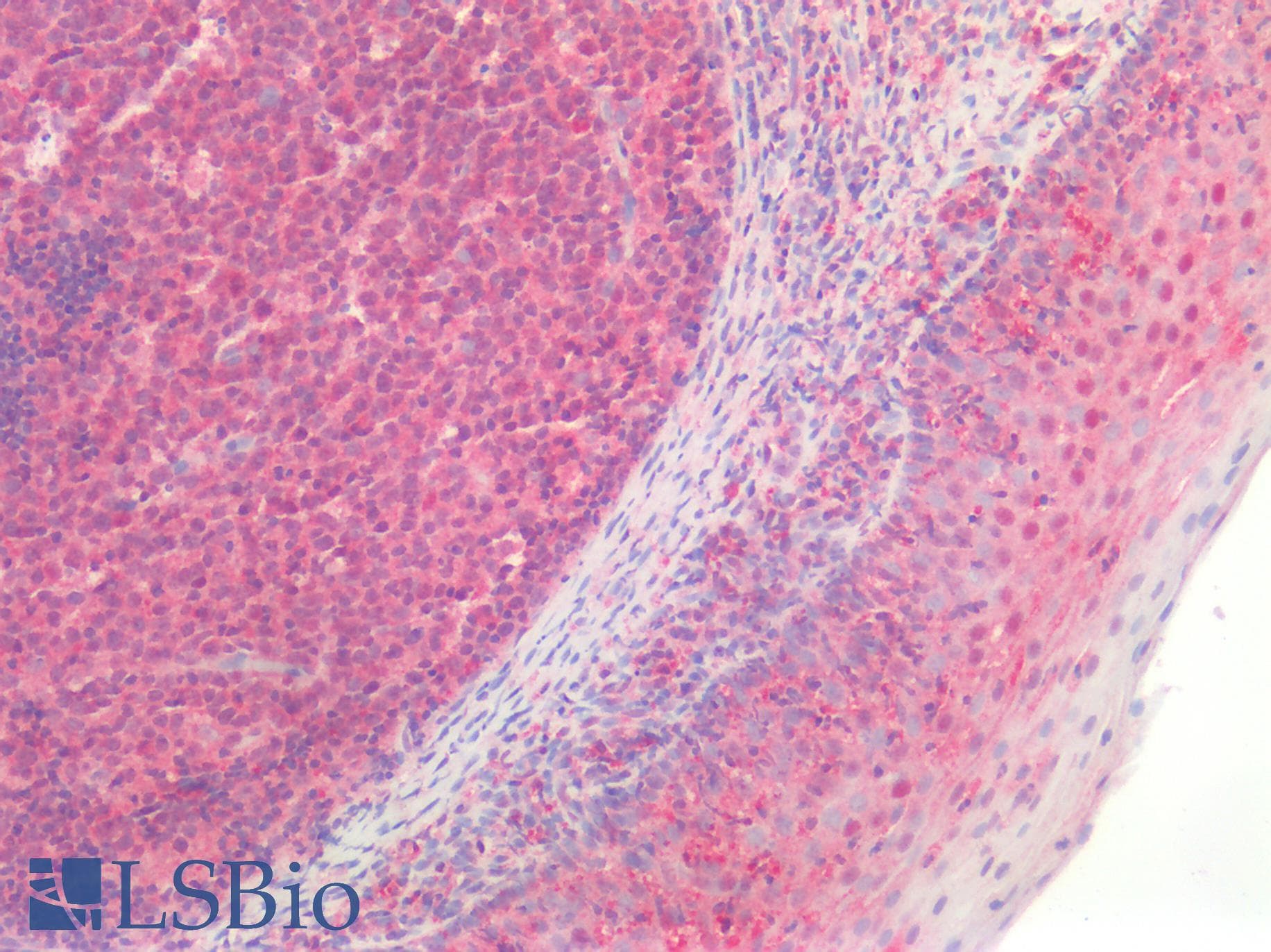 PathPlus™ Polyclonal Rabbit anti-Human MLPH / Melanophilin Antibody (IHC)