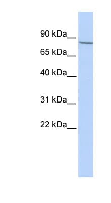 Polyclonal Rabbit anti-Human APP / Beta Amyloid Precursor Antibody (aa360-409, WB)