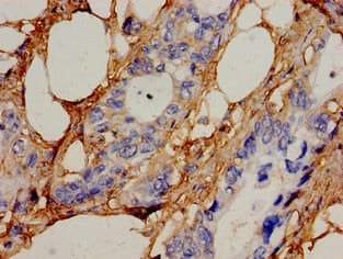 ICK Antibody