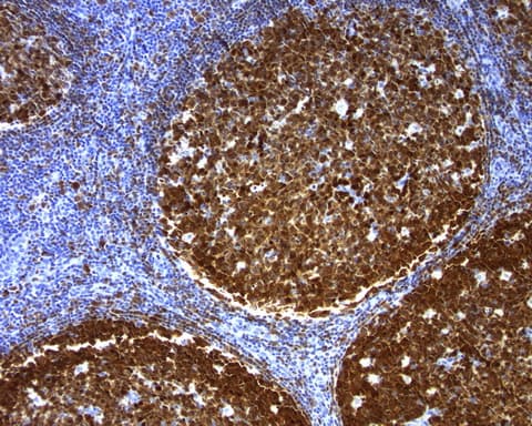 Monoclonal Mouse anti-Human POU2AF1 / BOB1 Antibody (clone UMAB219, IHC)