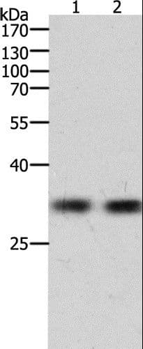 Polyclonal Rabbit anti-Human HAVCR1 / KIM-1 Antibody (WB)