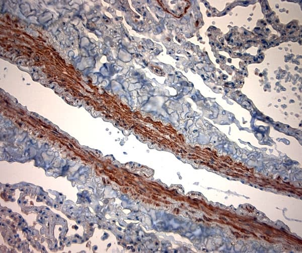 TPC2 / TPCN2 Antibody (aa700-752)