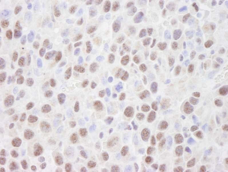 HDAC2 Antibody (aa425-C-term)