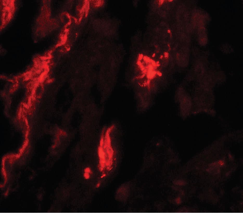 IHC-plus™ TFEB Antibody