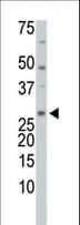 TRP32 / TXNL1 Antibody (aa256-289)