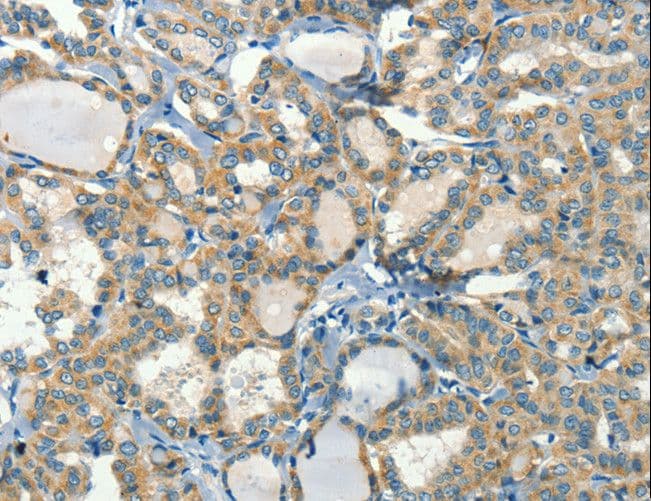 CALCA Antibody