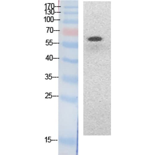 Polyclonal Rabbit anti-Human RELA / NFKB p65 Antibody (around the acetylation site of K314/K315., WB)