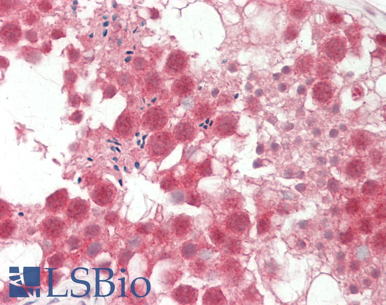 DGAT2 Antibody (aa208-257)