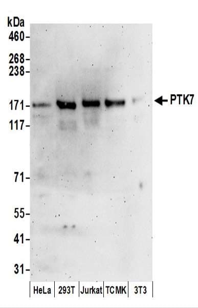CCK4 / PTK7 Antibody (aa700-750)