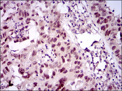 TP53BP1 / 53BP1 Antibody (aa574-773, clone 6B3E10)