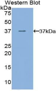 Polyclonal Rabbit anti-Mouse FLT4 / VEGFR3 Antibody (aa30-326, WB)