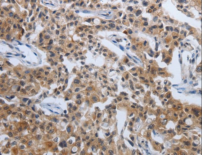 PDCD7 Antibody
