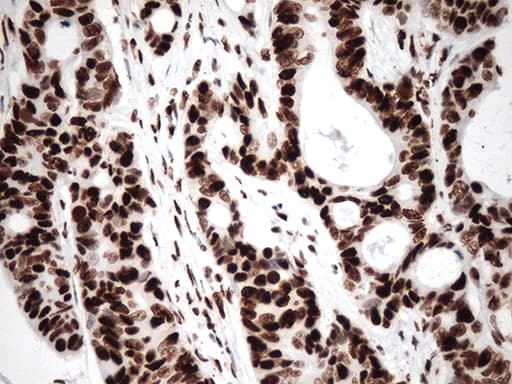 TRIM28 / KAP1 Antibody (clone OTI9F4)