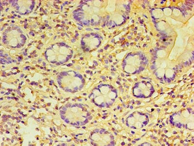 PRAME Antibody (aa1-509)