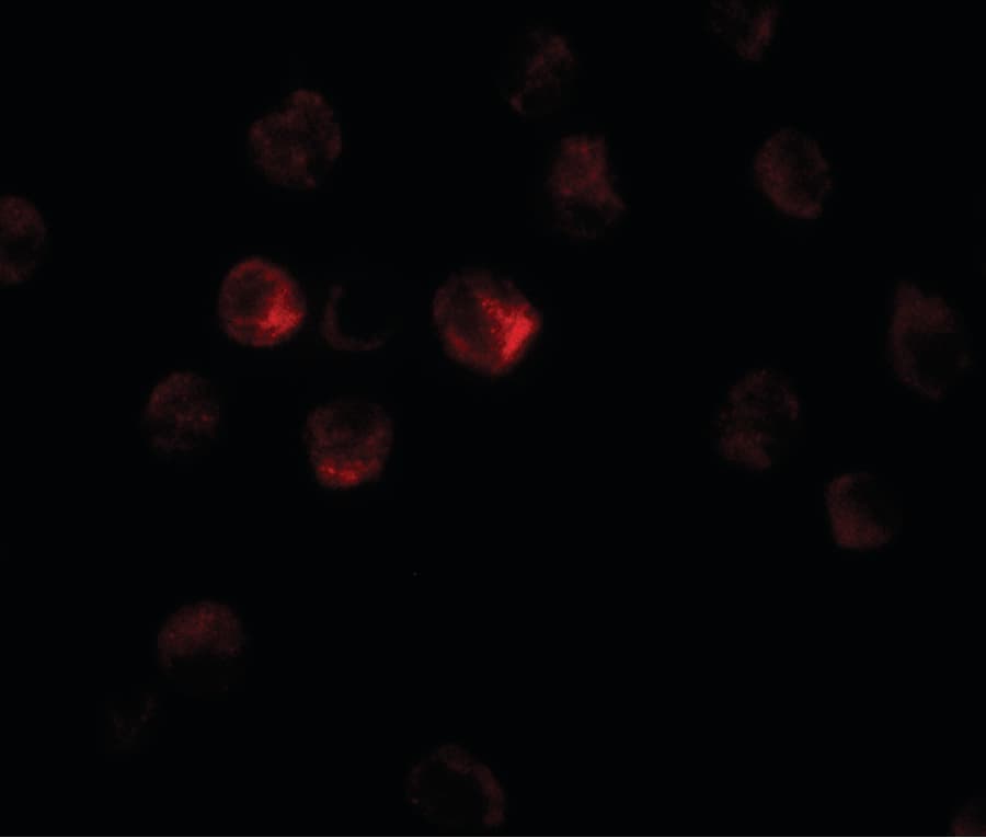 IHC-plus™ TCTEX1D1 Antibody