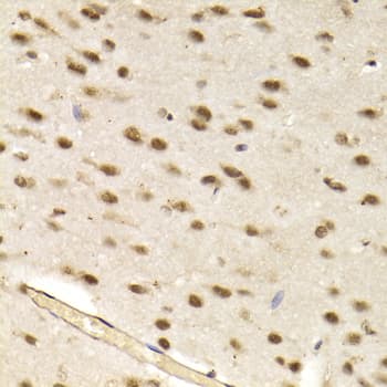 CBX8 Antibody