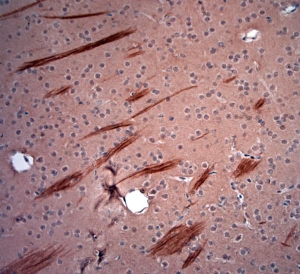 NEFH / NF-H Antibody (aa150-200)