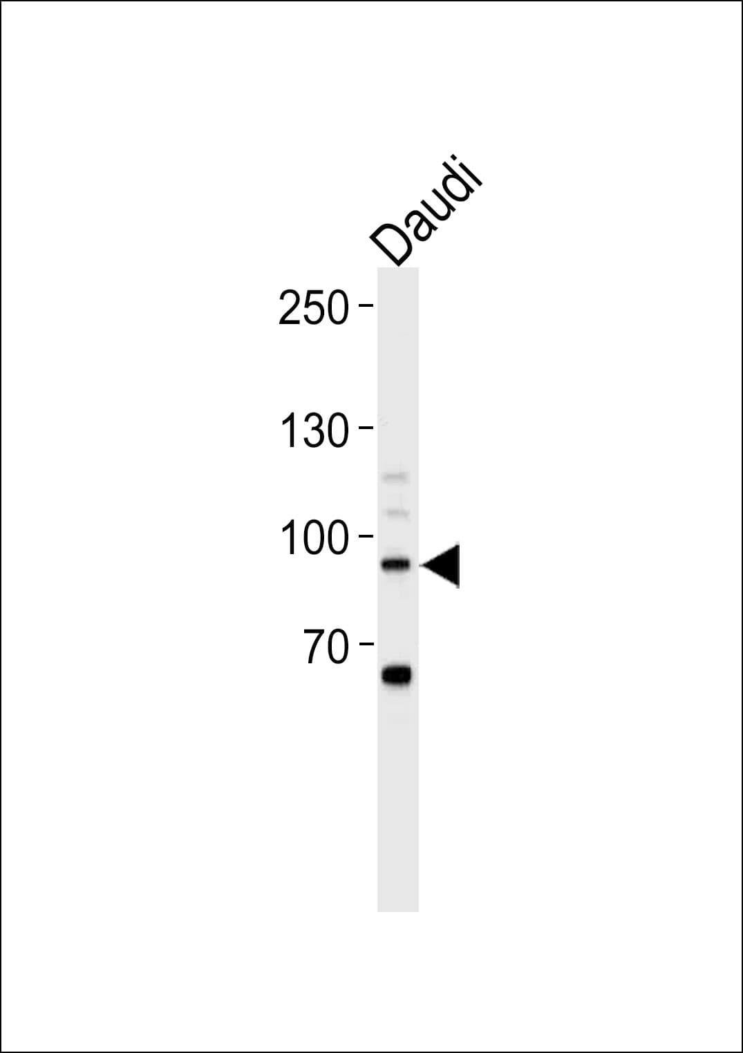STAT3 Antibody