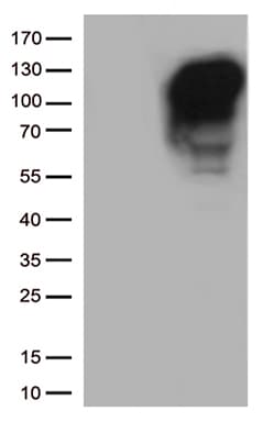 MME / CD10 Antibody (aa411-750, clone UMAB235)