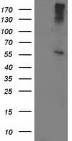 ATP6V1B1 Antibody (clone OTI6D2)