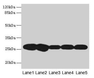 FKBP25 / FKBP3 Antibody (aa2-224)