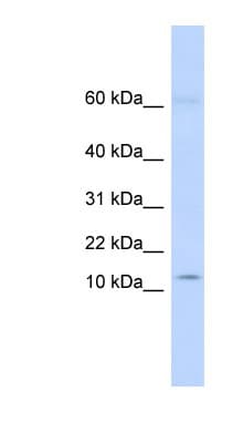 KRTAP8-1 Antibody (N-Terminus)