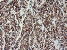 Monoclonal Mouse anti-Human MTFMT Antibody (clone OTI1E7, aa175-389, IHC, WB)