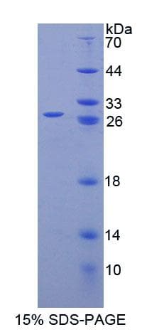 Mouse SPA17 / Sperm Protein 17 (Recombinant His-T7)