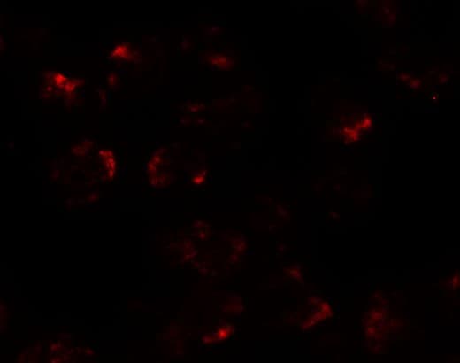 IHC-plus™ KPNA5 Antibody