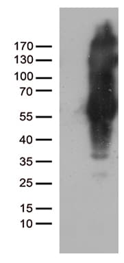 Monoclonal Mouse anti-Human IKBKG / NEMO / IKK Gamma Antibody (clone OTI6B7, Carrier-free, WB)