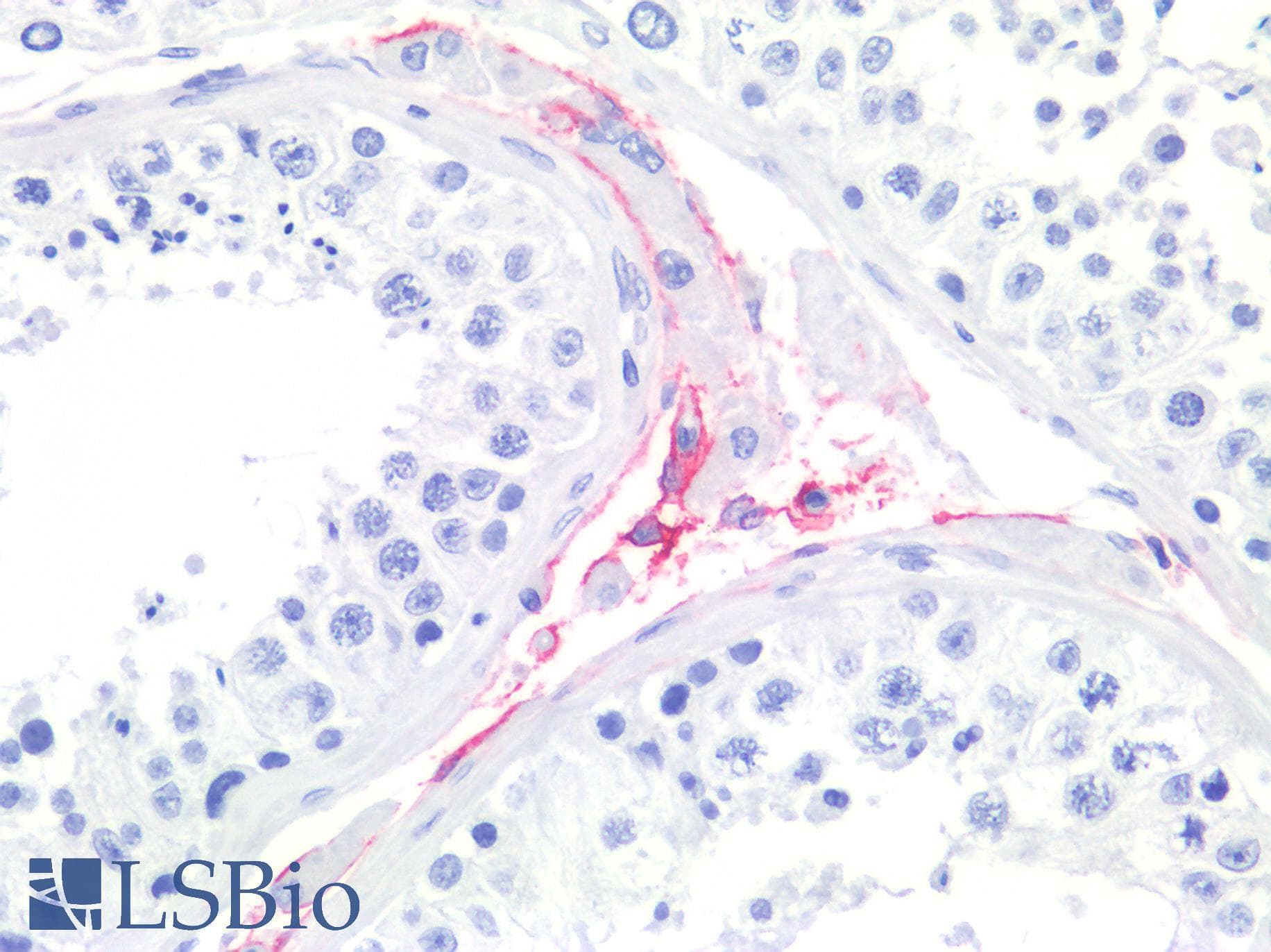 PathPlus™ NGFR / CD271 / TNR16 Antibody (clone NGFR5)