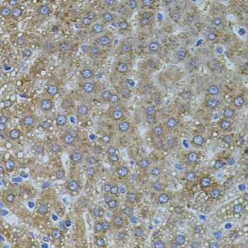 Polyclonal Rabbit anti-Human VEGFC Antibody (IHC, WB)