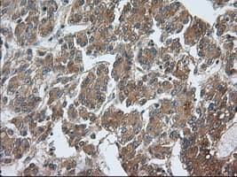 Monoclonal Mouse anti-Human PDE4A / PDE4 Antibody (clone OTI6D6, IHC, IF, WB)