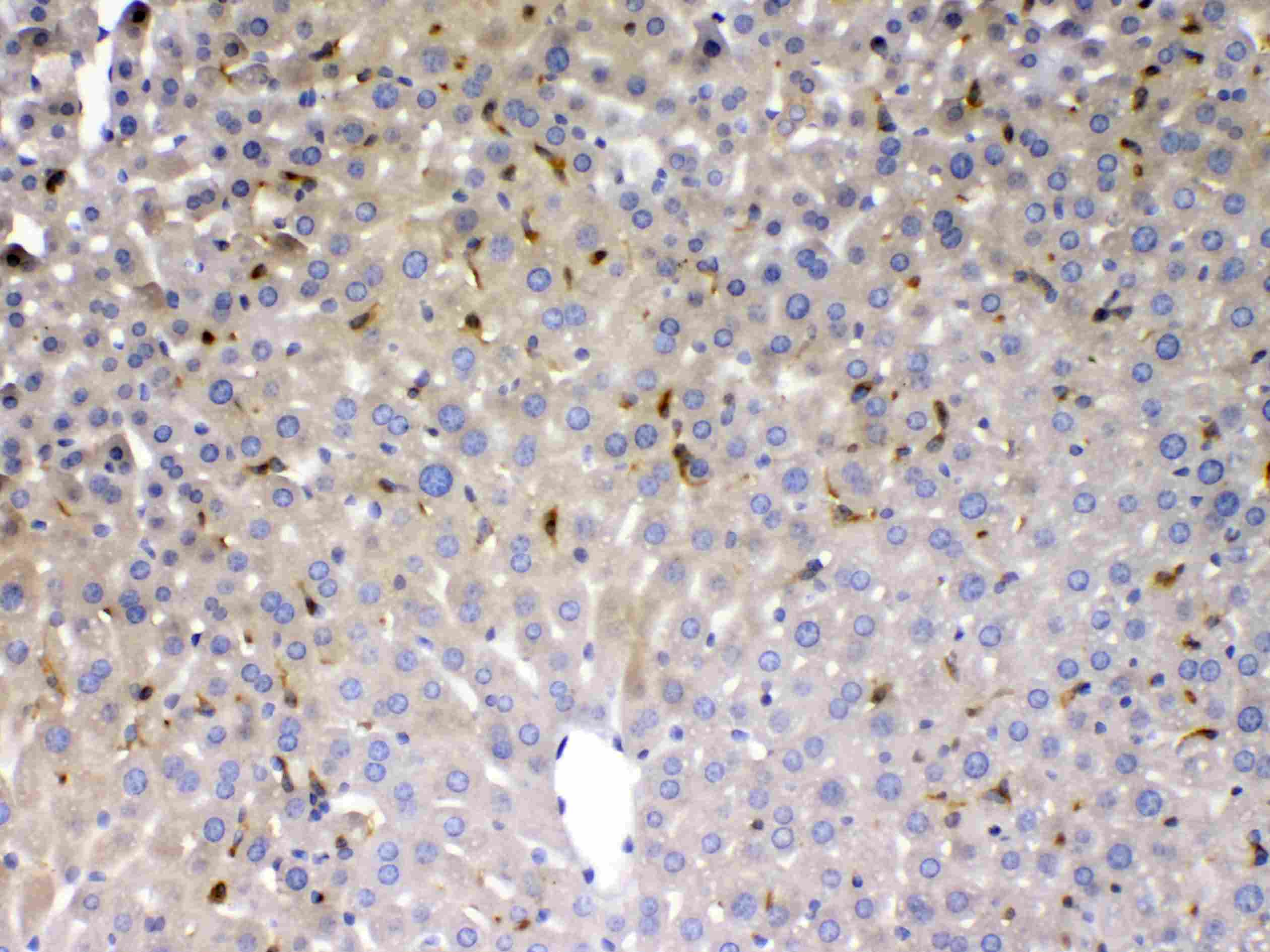 PSAT1 Antibody