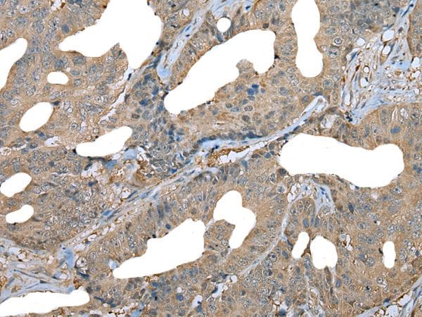 DDC / DOPA Decarboxylase Antibody