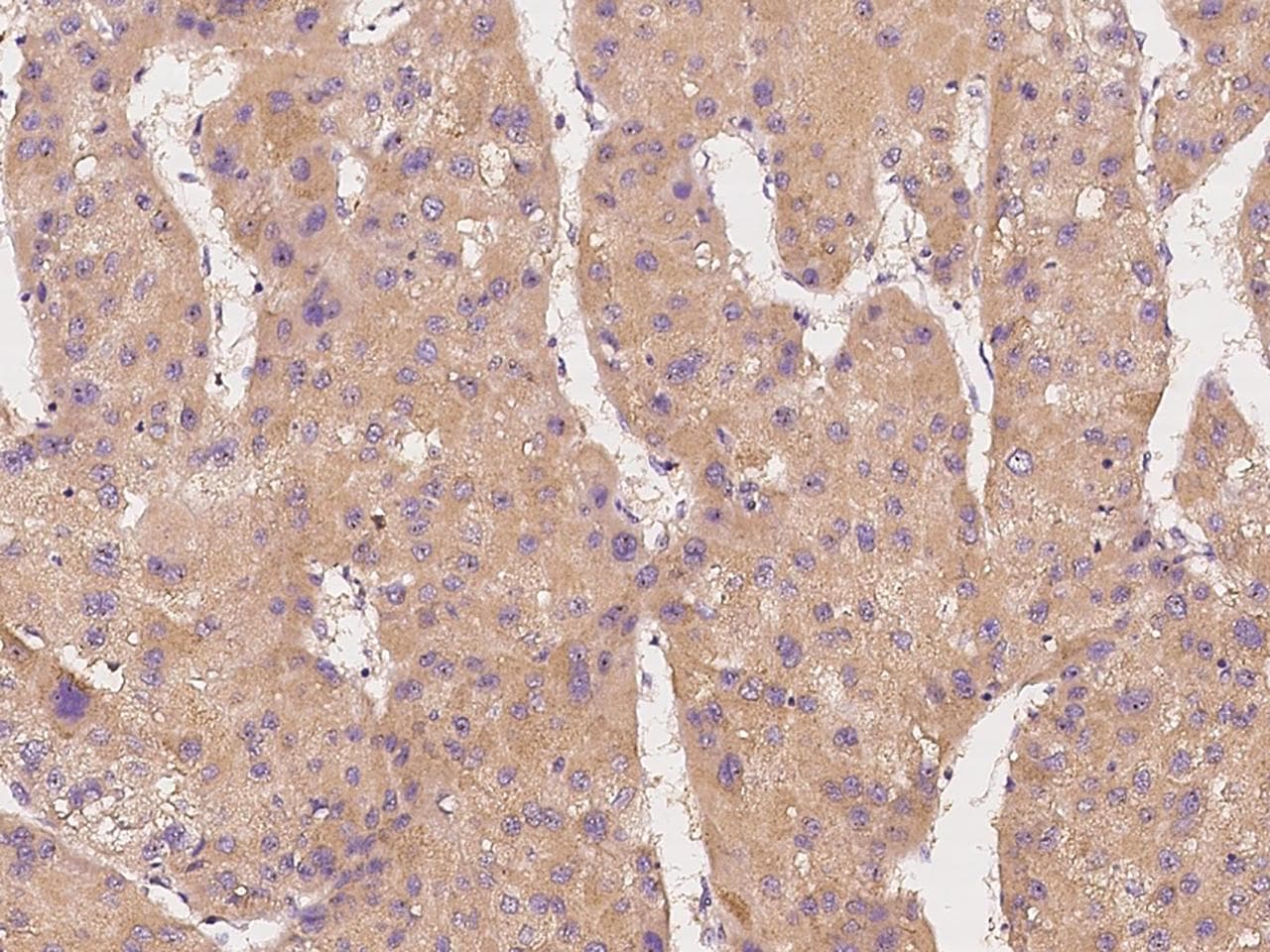 CSNK1G2 / CKI-Gamma 2 Antibody (Preservative Free)