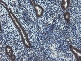 UBE2E3 Antibody (clone OTI1B4)
