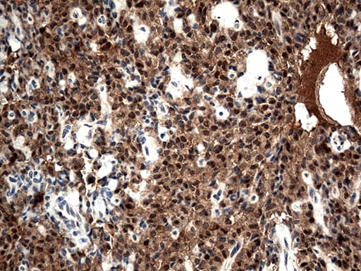CSTB / Cystatin B / Stefin B Antibody (aa1-98, clone OTI5F2, Carrier-free)
