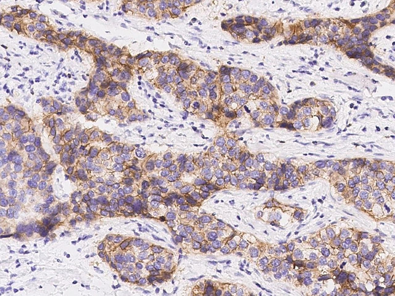 ERBB2 / HER2 Antibody (clone 40, Preservative Free)