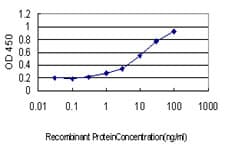 IHC-plus™ ATP2A3 / SERCA3 Antibody (clone 2H3)